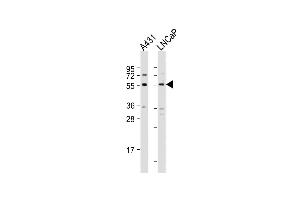 All lanes : Anti-SUFU Antibody (C-term) at 1:2000 dilution Lane 1: A431 whole cell lysate Lane 2: LNCaP whole cell lysate Lysates/proteins at 20 μg per lane.