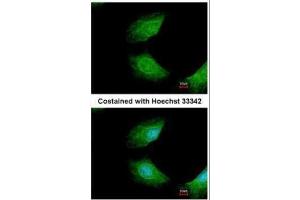 ICC/IF Image Immunofluorescence analysis of methanol-fixed HeLa, using CIAPIN1, antibody at 1:200 dilution. (CIAPIN1 抗体)