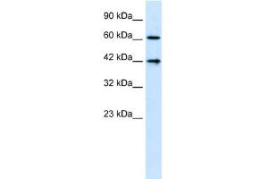 WB Suggested Anti-CFLAR  Antibody Titration: 1. (FLIP 抗体  (N-Term))