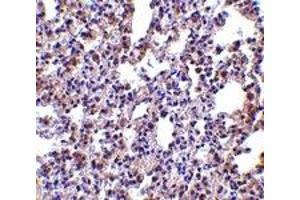 Immunohistochemistry (IHC) image for anti-Eukaryotic Translation Initiation Factor 2-alpha Kinase 2 (EIF2AK2) (C-Term) antibody (ABIN1030589) (EIF2AK2 抗体  (C-Term))