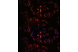 Immunofluorescence analysis of U-2 OS cells using RA antibody (ABIN3015732, ABIN3015733, ABIN3015734, ABIN1682427 and ABIN1682428) at dilution of 1:100. (RAB27A 抗体  (AA 1-221))