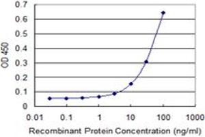 Detection limit for recombinant GST tagged RING1 is 1 ng/ml as a capture antibody. (RING1 抗体  (AA 81-170))