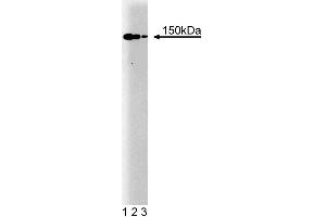 Western blot analysis of p150 [Glued] on a human endothelial cell lysate. (Dynactin 1 抗体  (AA 3-202))