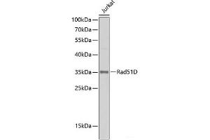 RAD51D 抗体