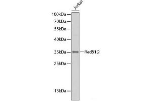 Western blot analysis of extracts of Jurkat cells using Rad51D Polyclonal Antibody at dilution of 1:500. (RAD51D 抗体)