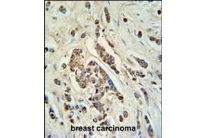Immunohistochemistry (Paraffin-embedded Sections) (IHC (p)) image for anti-ATP-Binding Cassette, Sub-Family C (CFTR/MRP), Member 11 (ABCC11) (AA 343-372), (N-Term) antibody (ABIN650984)