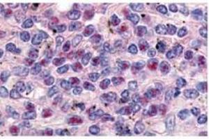 Anti-Cyclin L1a Antibody - Immunohistochemistry  anti-Cyclin L1a antibody was used at a 10 µg/ml to detect Cyclin L1ain a variety of tissues including breast (collagen), heart, kidney (distal tubules), liver, skeletal muscle, ovary (granulosa and oocyte), pancreas (islet), placenta (trophoblast), prostate (epithelium), skin, spleen (endothelium), stomach (chief), testes (seminiferous epithelium and leydig), thymus (Has-sal's corpuscle and lymphocytes) and uterus (glandular epithelium and stroma). (Cyclin L1 抗体  (AA 314-369))