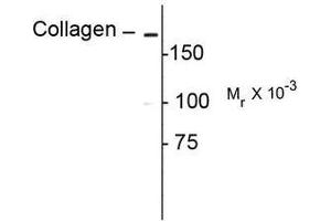 Image no. 1 for anti-Collagen, Type I (COL1) antibody (ABIN372599) (Collagen Type I 抗体)