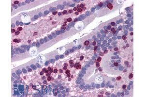 ABIN185717 (3. (ALOX5AP 抗体  (Internal Region))