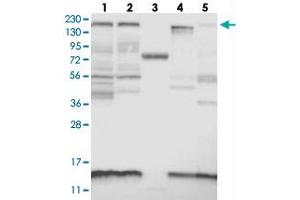 Western blot analysis of Lane 1: RT-4, Lane 2: U-251 MG, Lane 3: Human Plasma, Lane 4: Liver, Lane 5: Tonsil with KIAA1009 polyclonal antibody . (KIAA1009 (KIAA1009) 抗体)