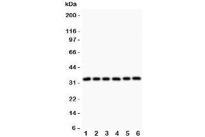 Western blot testing of MyD88 antibody and Lane 1:  rat heart;  2: human HeLa;  3: (h) MCF7;  4: (h) HEPG2;  5: (h) Jurkat;  6: (h) Raji. (MYD88 抗体  (AA 44-264))