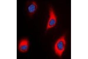 Immunofluorescent analysis of Tensin 3 staining in HeLa cells. (TNS3 抗体)