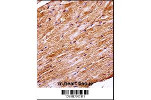 Mouse Mapk4 Antibody immunohistochemistry analysis in formalin fixed and paraffin embedded mouse heart tissue followed by peroxidase conjugation of the secondary antibody and DAB staining.