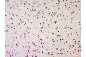 Formalin-fixed and paraffin embedded mouse brain labeled with Anti-LRP1/CD91 Polyclonal Antibody, Unconjugated  at 1:200 followed by conjugation to the secondary antibody and DAB staining.