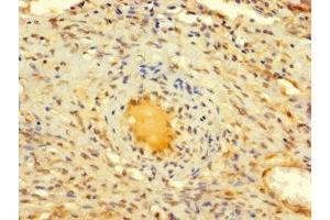 Immunohistochemistry of paraffin-embedded human ovarian tissue using ABIN7150017 at dilution of 1:100 (DIS3L2 抗体  (AA 201-400))