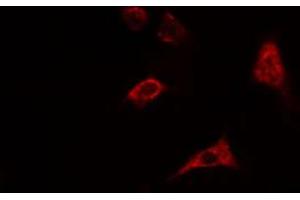 ABIN6274550 staining HepG2 cells by IF/ICC. (CHKB 抗体  (C-Term))