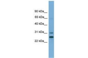 Image no. 1 for anti-Dehydrogenase/reductase (SDR Family) Member 2 (DHRS2) (AA 27-76) antibody (ABIN6745489) (DHRS2 抗体  (AA 27-76))