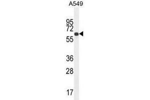 ZNF324B Antibody (C-term) western blot analysis in A549 cell line lysates (35 µg/lane). (ZNF324B 抗体  (C-Term))