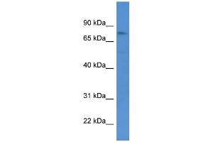 WB Suggested Anti-GSG2 Antibody Titration: 0. (GSG2 抗体  (Middle Region))