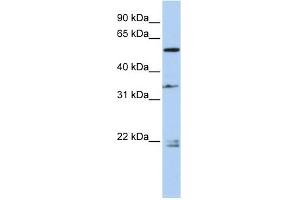 WB Suggested Anti-DPYSL2 Antibody Titration: 0. (DPYSL2 抗体  (Middle Region))