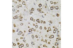 Immunohistochemistry of paraffin-embedded mouse brain using CEP164 antibody. (CEP164 抗体)