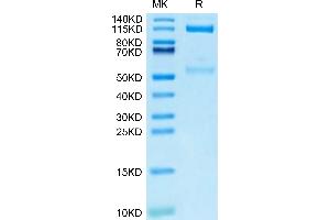 Mouse ITGAV&ITGB3 on Tris-Bis PAGE under reduced condition. (CD51/CD61 Protein (AA 31-988) (Fc Tag))