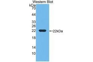 Detection of Recombinant DBP, Rat using Monoclonal Antibody to Vitamin D Binding Protein (DBP) (Vitamin D-Binding Protein 抗体  (AA 209-394))