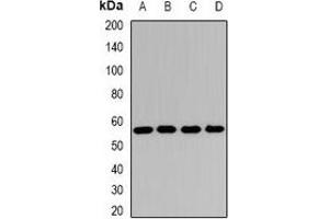 Western blot analysis of SCOT expression in Hela (A), Jurkat (B), mouse heart (C), rat kidney (D) whole cell lysates. (OXCT1 抗体)
