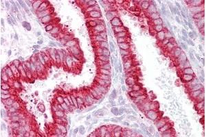 anti-Cholinergic Receptor, Nicotinic, beta 2 (Neuronal) (CHRNB2) (Internal Region) antibody