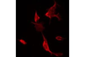 ABIN6266541 staining NIH-3T3 by IF/ICC. (FLI1 抗体  (Internal Region))