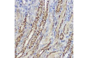 Immunohistochemistry of paraffin-embedded rat spleen using [KO Validated] Heme Oxygenase 1 (HO-1/HMOX1) Rabbit pAb (ABIN6131781, ABIN6141881, ABIN6141883 and ABIN6215065) at dilution of 1:50 (40x lens). (HMOX1 抗体  (AA 1-288))
