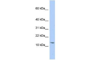WB Suggested Anti-SNRPD2 Antibody Titration:  0. (SNRPD2 抗体  (N-Term))