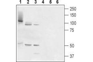 Western blot analysis of rat prostate (lanes 1 and 4), testis (lanes 2 and 5) and placenta (lanes 3 and 6): - 1-3. (TMC6 抗体  (Cytosolic, Intracellular))