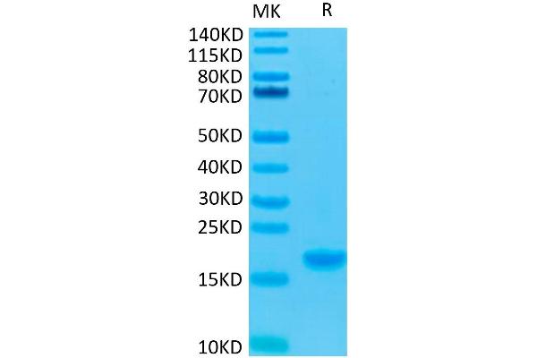 IL-7 Protein (AA 26-177)