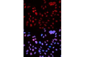 Immunofluorescence (IF) image for anti-Tumor Protein P53 (TP53) (pSer9) antibody (ABIN3023604)