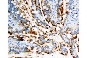 Anti-APE1 antibody, IHC(P) IHC(P): Rat Intestine Tissue (APEX1 抗体  (Middle Region))