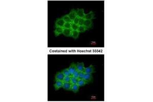 ICC/IF Image Immunofluorescence analysis of methanol-fixed A431, using SEC61A1, antibody at 1:200 dilution.