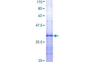 Image no. 1 for Chemokine (C-X-C Motif) Ligand 13 (CXCL13) (AA 23-109) protein (GST tag) (ABIN2752770)