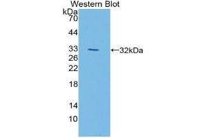 Detection of Recombinant LIPG, Mouse using Polyclonal Antibody to Lipase, Endothelial (LIPG) (LIPG 抗体  (AA 115-369))