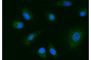 anti-14-3-3 epsilon (YWHAE) (AA 16-163) antibody