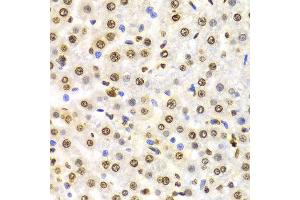 Immunohistochemistry (IHC) image for anti-Histone 3 (H3) (H3K9me3) antibody (ABIN3016030)