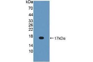 Detection of Recombinant BPI, Mouse using Polyclonal Antibody to Bactericidal/Permeability Increasing Protein (BPI) (BPI 抗体  (AA 320-457))