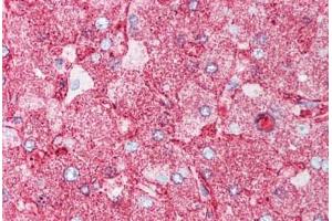 Human Liver (formalin-fixed, paraffin-embedded) stained with MINK1 antibody ABIN213551 at 5 ug/ml followed by biotinylated goat anti-rabbit IgG secondary antibody ABIN481713, alkaline phosphatase-streptavidin and chromogen. (MAP4K6 抗体  (Internal Region))