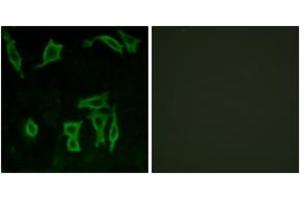 Immunofluorescence analysis of LOVO cells, using GRM5 Antibody. (Metabotropic Glutamate Receptor 5 抗体  (AA 21-70))