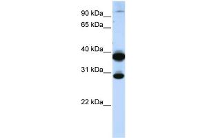 WB Suggested Anti-ZNF138 Antibody Titration:  0. (ZNF138 抗体  (C-Term))