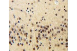 Used in DAB staining on fromalin fixed paraffin-embedded Brain tissue (Plakophilin 2 抗体  (AA 571-849))