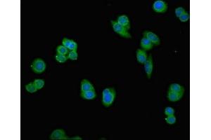 Immunofluorescent analysis of PC-3 cells using ABIN7164927 at dilution of 1:100 and Alexa Fluor 488-congugated AffiniPure Goat Anti-Rabbit IgG(H+L) (PSMG1 抗体  (AA 91-200))