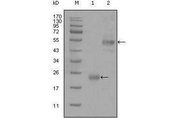 CD44 抗体