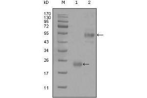 Western blot analysis using CD44 mouse mAb against truncated Trx-CD44 recombinant protein (1) and GST-CD44 (aa628-699) recombinant protein (2). (CD44 抗体)