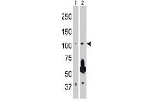 The MAP3K14 polyclonal antibody  is used in Western blot to detect MAP3K14 in 293 cell lysate (Lane 1) and rat testis tissue lysate (Lane 2) .